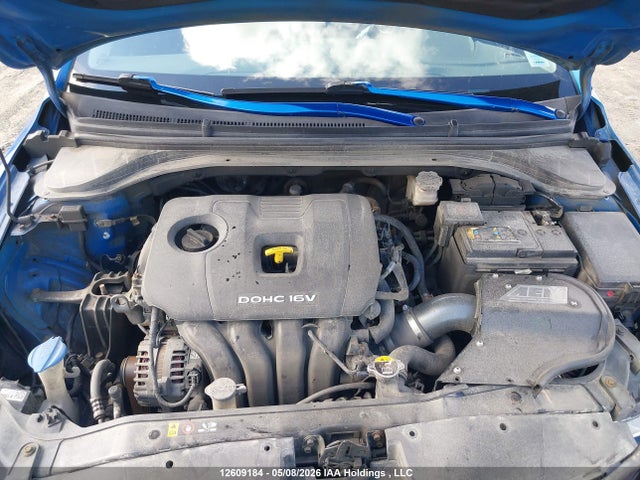 KMHD84LFXJU540902 Hyundai Elantra Sel/value/limited