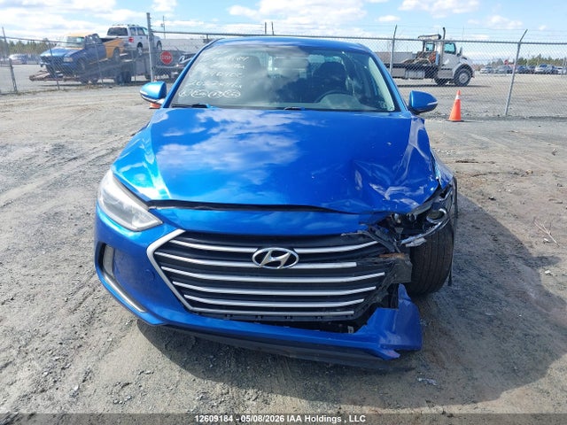 KMHD84LFXJU540902 Hyundai Elantra Sel/value/limited