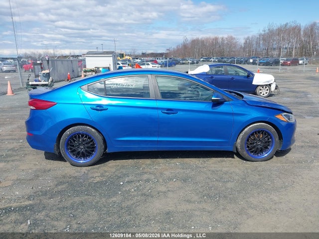 KMHD84LFXJU540902 Hyundai Elantra Sel/value/limited