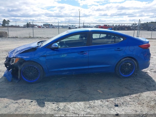 KMHD84LFXJU540902 Hyundai Elantra Sel/value/limited