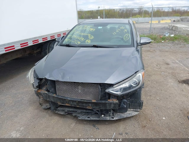 KMHD84LF2HU136681 Hyundai Elantra