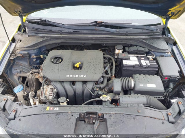 KMHD84LF3HU404024 Hyundai Elantra Gls