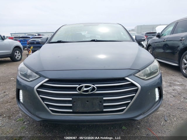 KMHD84LF3HU088785 Hyundai Elantra Gls