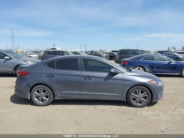 KMHD84LF3HU336467 Hyundai ELANTRA GL