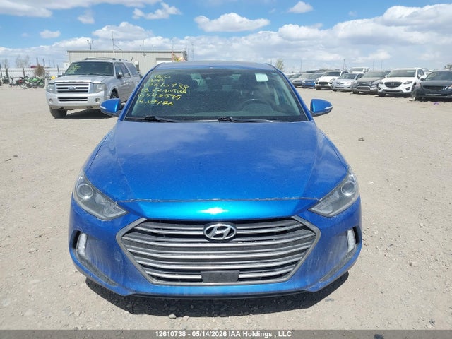KMHD84LF4JU542595 Hyundai Elantra Gls