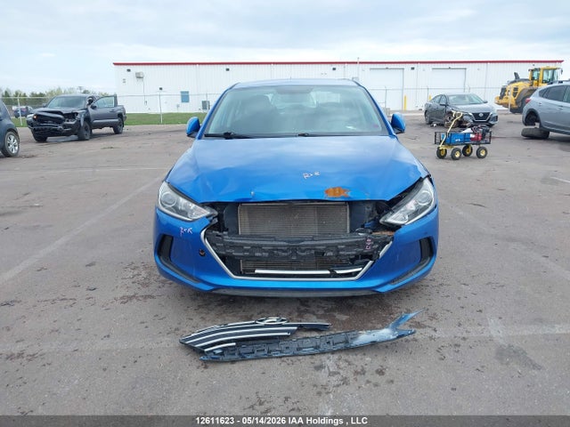 KMHD84LF5JU618874 Hyundai ELANTRA GL