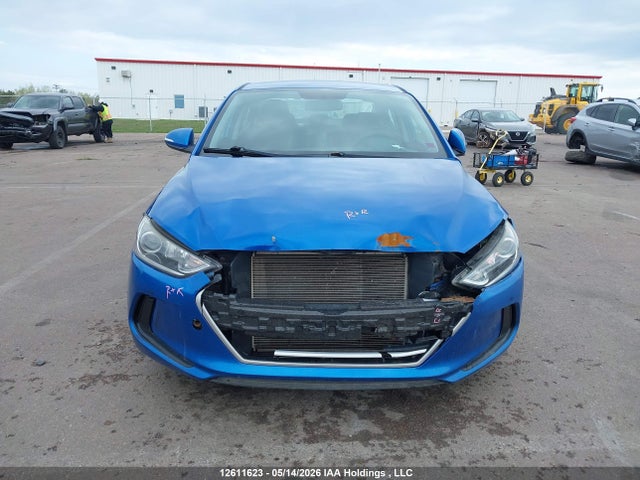 KMHD84LF5JU618874 Hyundai ELANTRA GL
