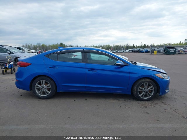 KMHD84LF5JU618874 Hyundai ELANTRA GL