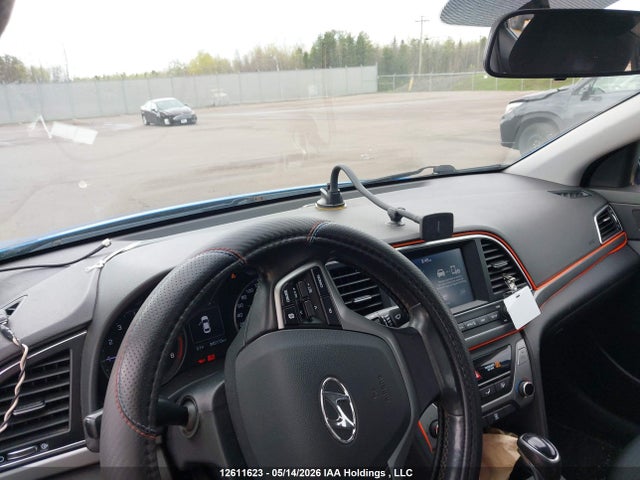 KMHD84LF5JU618874 Hyundai ELANTRA GL