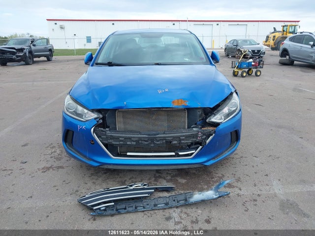 KMHD84LF5JU618874 Hyundai ELANTRA GL