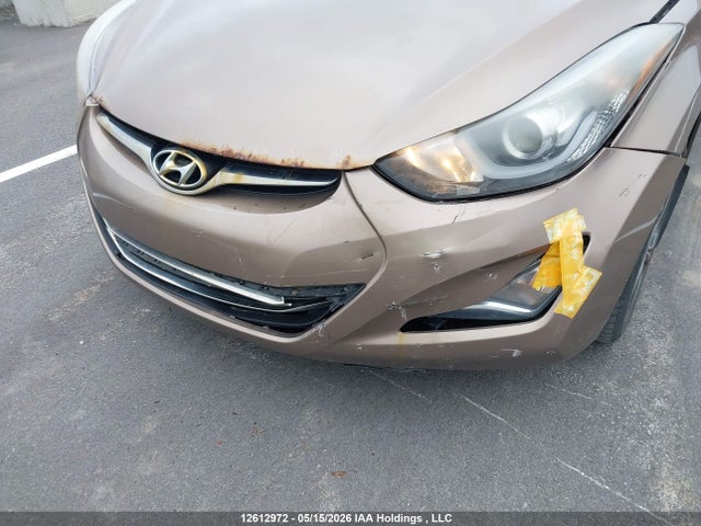 KMHDH4AH6EU143357 Hyundai Elantra Limited