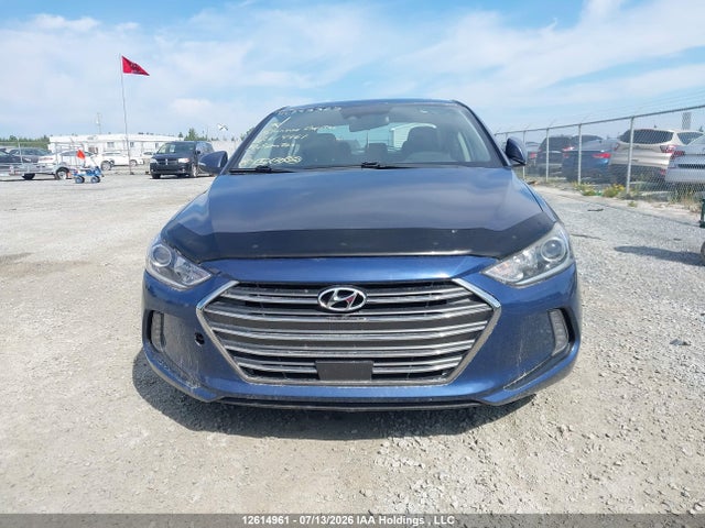 12614961 :رقم المزاد ، KMHD84LF8HU293325 vin ، 2017 Hyundai Elantra Se/value/limited مزاد بيع