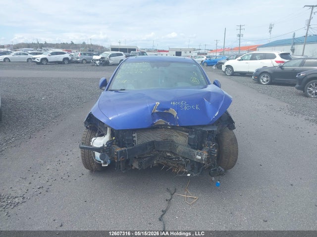 KMHD04LBXLU084228 Hyundai Elantra Sport Manual