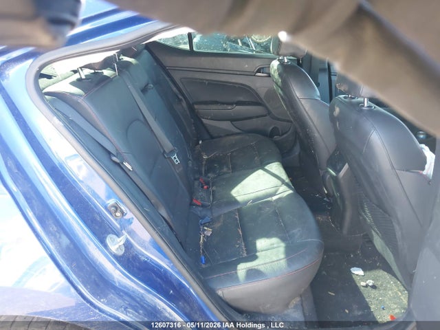 KMHD04LBXLU084228 Hyundai Elantra Sport Manual
