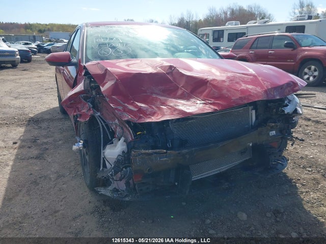 KMHLM4AG8MU100197 Hyundai ELANTRA SEL