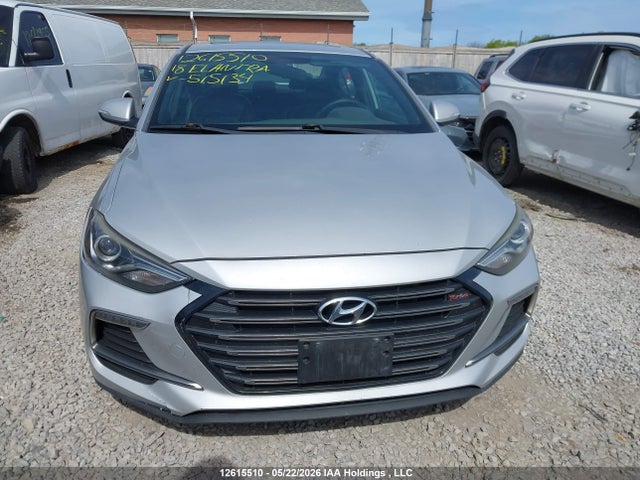 KMHD04LB3JU515134 Hyundai Elantra