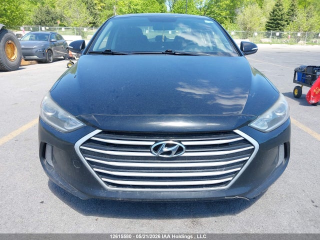 KMHD84LF4JU539146 Hyundai Elantra Sel/value/limited