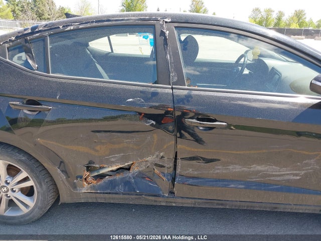 KMHD84LF4JU539146 Hyundai Elantra Sel/value/limited
