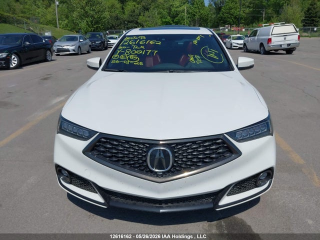 19UUB3F81LA802177 Acura Tlx Advance/pmc Edition