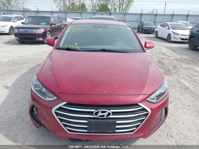 KMHD84LF6HU380561 Hyundai Elantra Gls