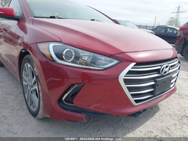 KMHD84LF6HU380561 Hyundai Elantra Gls