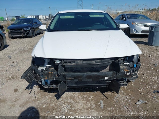 KMHLM4DG0RU666163 Hyundai ELANTRA SEL