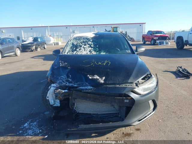 KMHD84LFXJU515949 Hyundai ELANTRA GL