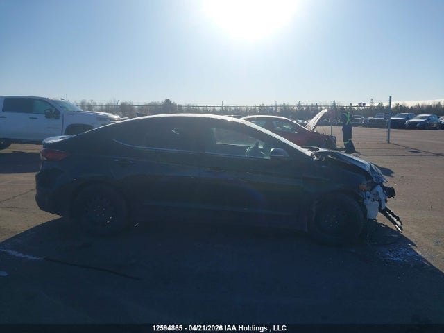 KMHD84LFXJU515949 Hyundai ELANTRA GL
