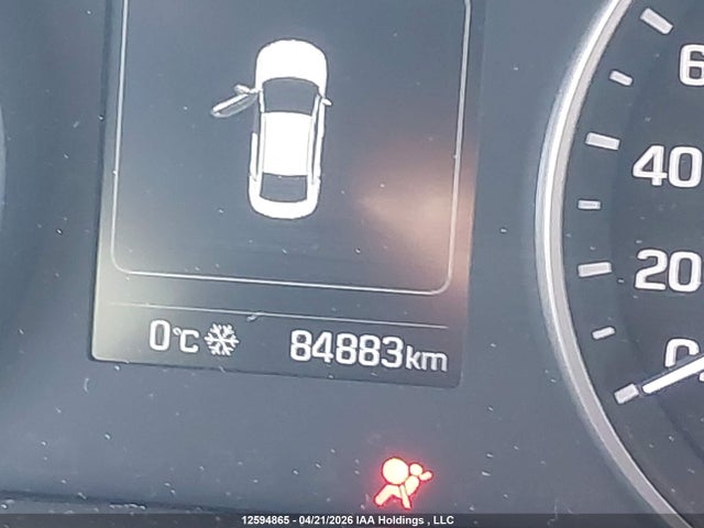 KMHD84LFXJU515949 Hyundai ELANTRA GL