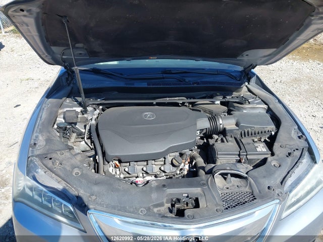 Acura TLX TECH 2015 19UUB3F58FA801652 Image 10