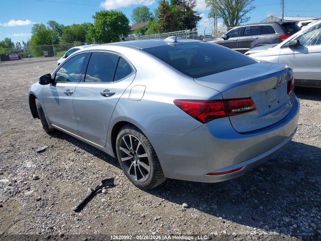 Acura TLX TECH 2015 19UUB3F58FA801652 Image 3