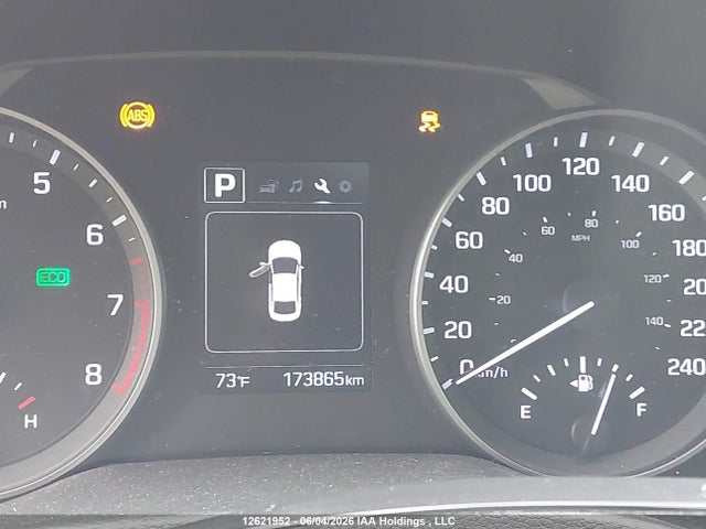 Продаж на аукціоні авто 2017 Hyundai Elantra Se/value/limited, vin: KMHD84LF4HU303638, номер лоту: 12621952