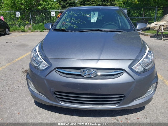 Продажа на аукционе авто 2017 Hyundai Accent Se, vin: KMHCT5AE1HU329267, номер лота: 12623647