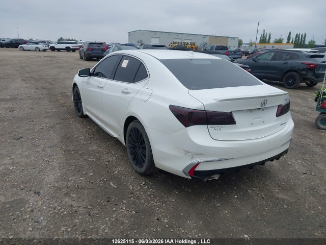 Acura Tlx Advance 2018 19UUB3F79JA801816 Image 3