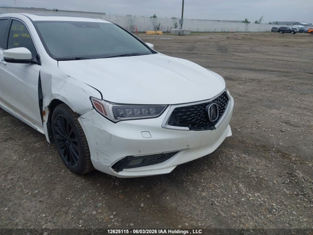 Acura Tlx Advance 2018 19UUB3F79JA801816 Image 6
