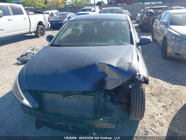 KMHD84LF1KU815641 Hyundai Elantra Sel/value/limited