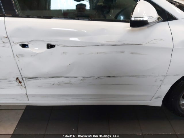 Продаж на аукціоні авто 2017 Hyundai Elantra Gl, vin: KMHD84LF1HU335995, номер лоту: 12623117