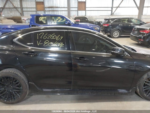 Acura TLX 2017 19UUB3F53HA801092 Image 14
