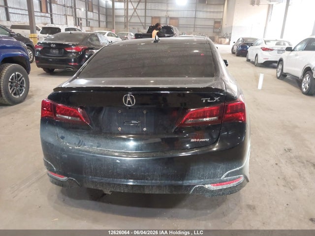 Acura TLX 2017 19UUB3F53HA801092 Image 17