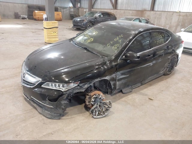 Acura TLX 2017 19UUB3F53HA801092 Image 2