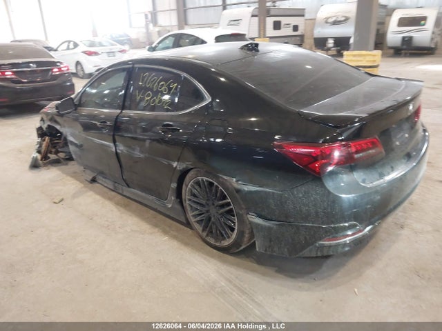 Acura TLX 2017 19UUB3F53HA801092 Image 3