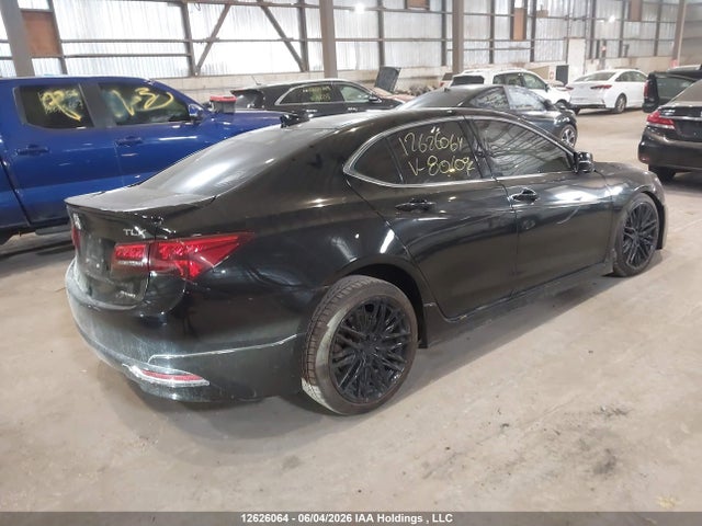 Acura TLX 2017 19UUB3F53HA801092 Image 4