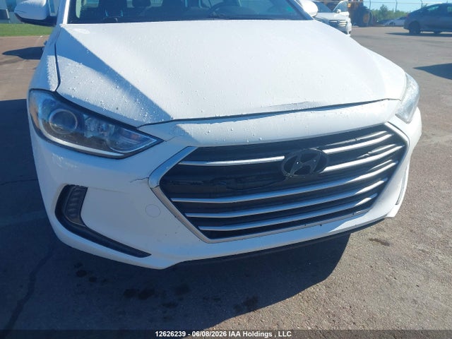 KMHD84LF6JU695088 Hyundai ELANTRA GL