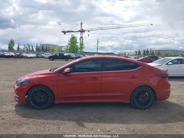 12629165 :رقم المزاد ، KMHD04LB3JU514839 vin ، 2018 Hyundai Elantra Sport مزاد بيع