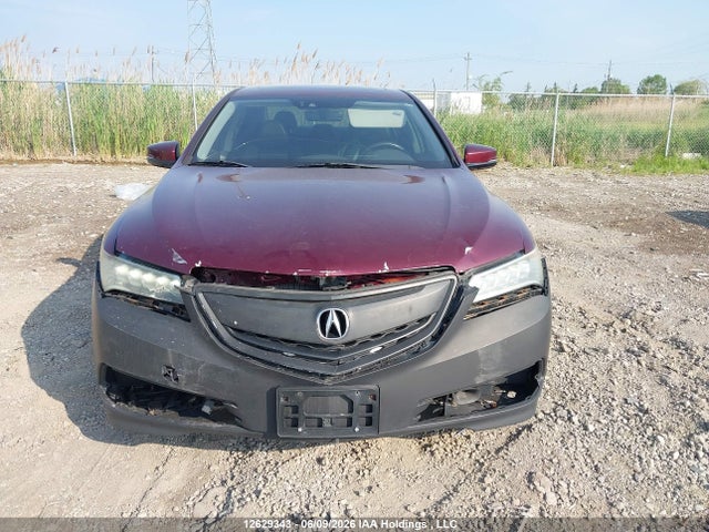 Acura Tlx V6 Tech 2015 19UUB2F53FA800807 Image 11