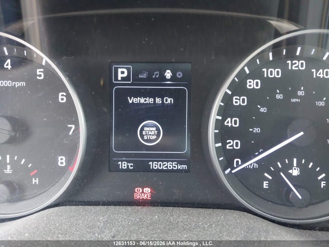 KMHD84LF6HU404762 Hyundai Elantra Gls