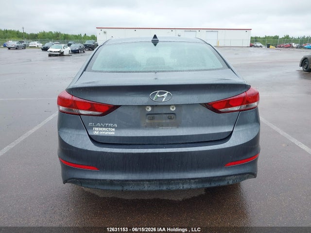 KMHD84LF6HU404762 Hyundai Elantra Gls