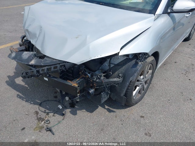 12633122 :رقم المزاد ، KMHD84LF2HU322396 vin ، 2017 Hyundai Elantra Se/value/limited مزاد بيع