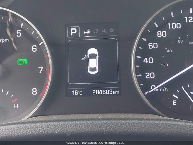 Продаж на аукціоні авто 2017 Hyundai Elantra Gl, vin: KMHD84LF0HU304396, номер лоту: 12633173