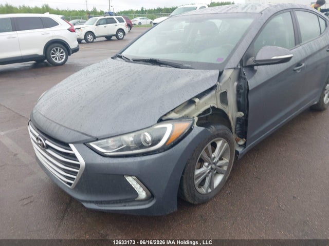 Продаж на аукціоні авто 2017 Hyundai Elantra Gl, vin: KMHD84LF0HU304396, номер лоту: 12633173